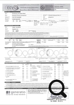Augenuntersuchung Eyes